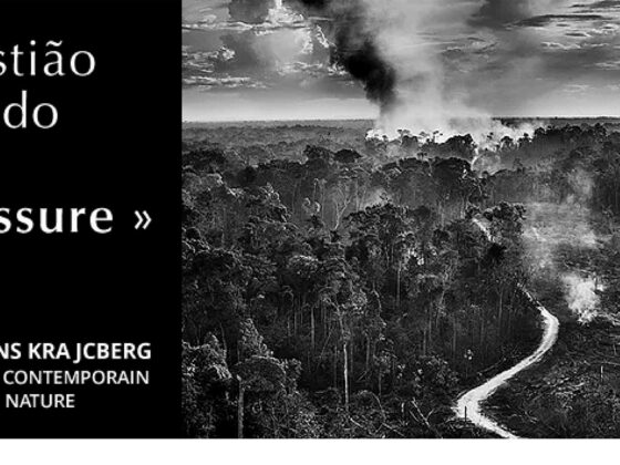 © - Blessure - Sebastião SALGADO