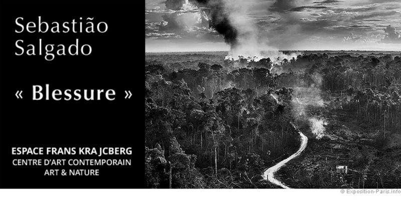 © - Blessure - Sebastião SALGADO